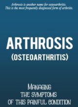 Arthrosis PLR - Sales Funnel-image
